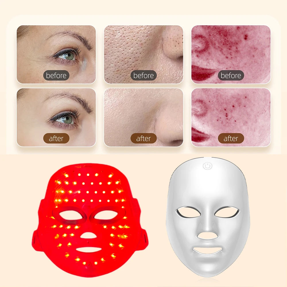 Rechargeable 7-Color LED Facial Mask | Light Therapy for Clear, Glowing Skin