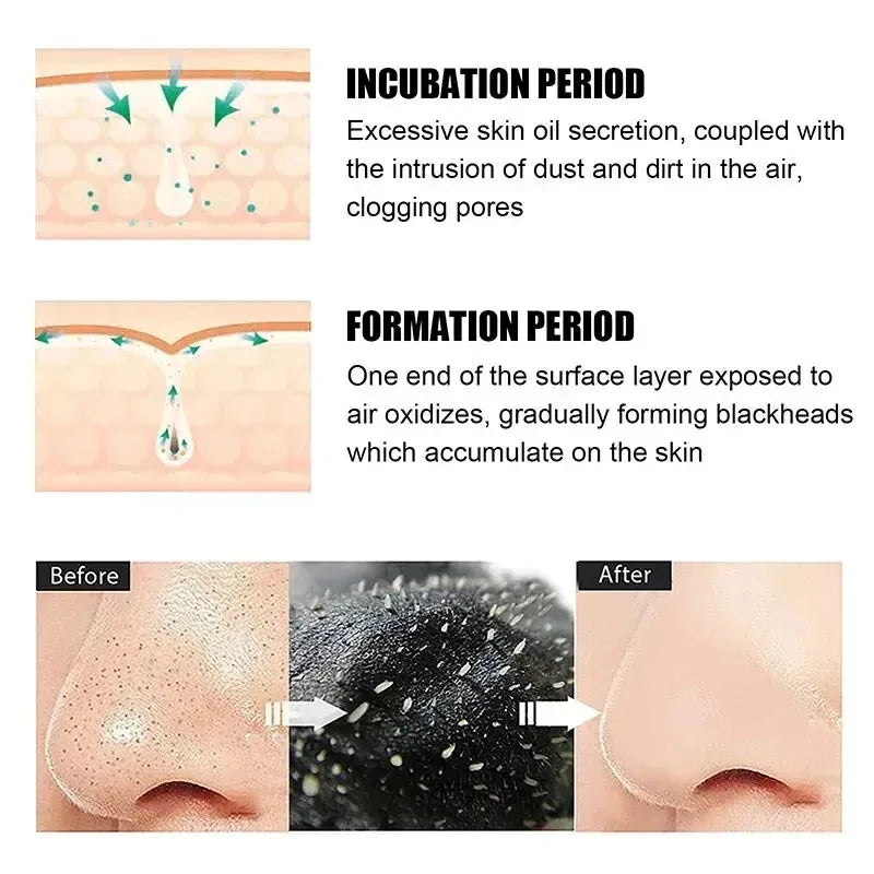 Deep Cleansing Nose Pore Strips | Blackhead Remover & Pore Care
